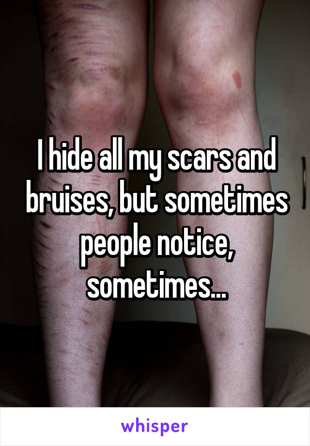 I hide all my scars and bruises, but sometimes people notice, sometimes...