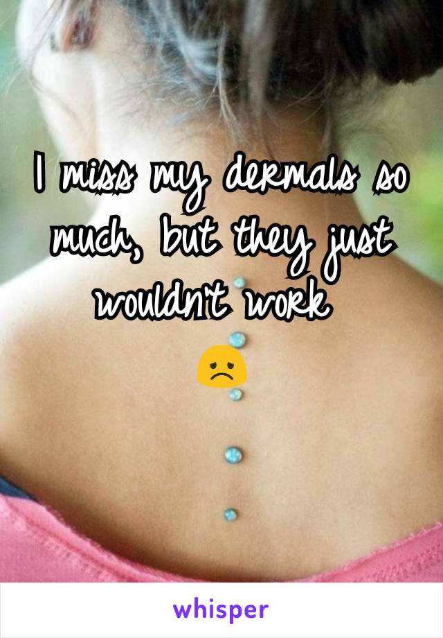 I miss my dermals so much, but they just wouldn't work 
😞