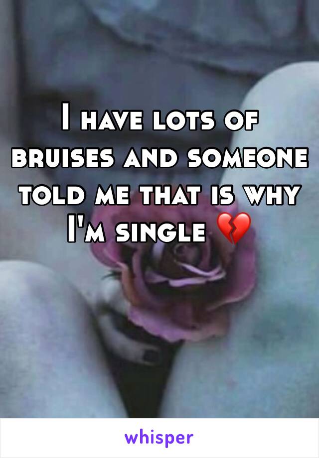 I have lots of bruises and someone told me that is why I'm single 💔