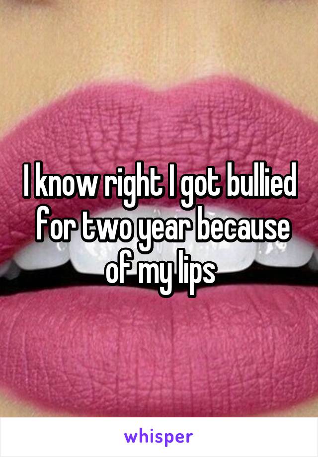 I know right I got bullied  for two year because of my lips