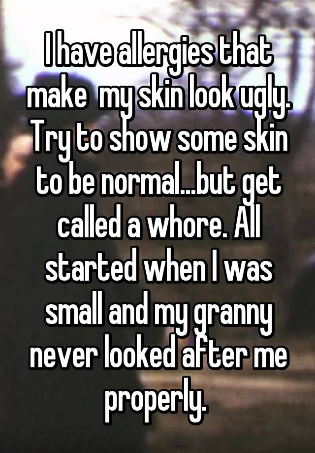 I have allergies that make  my skin look ugly. Try to show some skin to be normal...but get called a whore. All started when I was small and my granny never looked after me properly. 