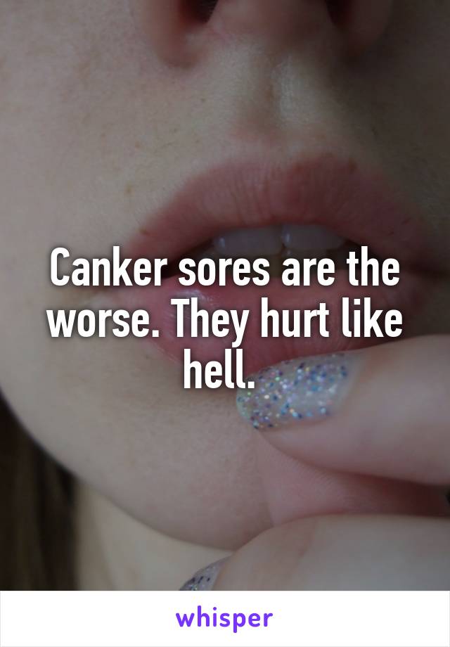 Canker sores are the worse. They hurt like hell. 