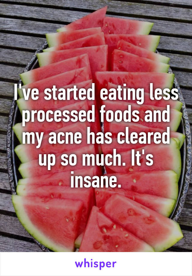 I've started eating less processed foods and my acne has cleared up so much. It's insane.