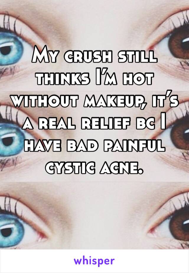 My crush still thinks I’m hot without makeup, it’s a real relief bc I have bad painful cystic acne.