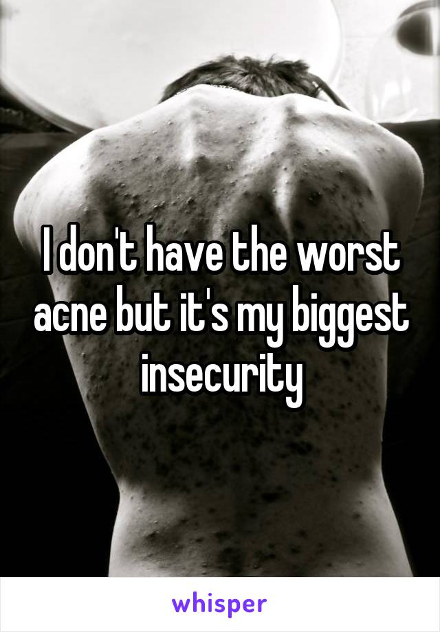 I don't have the worst acne but it's my biggest insecurity