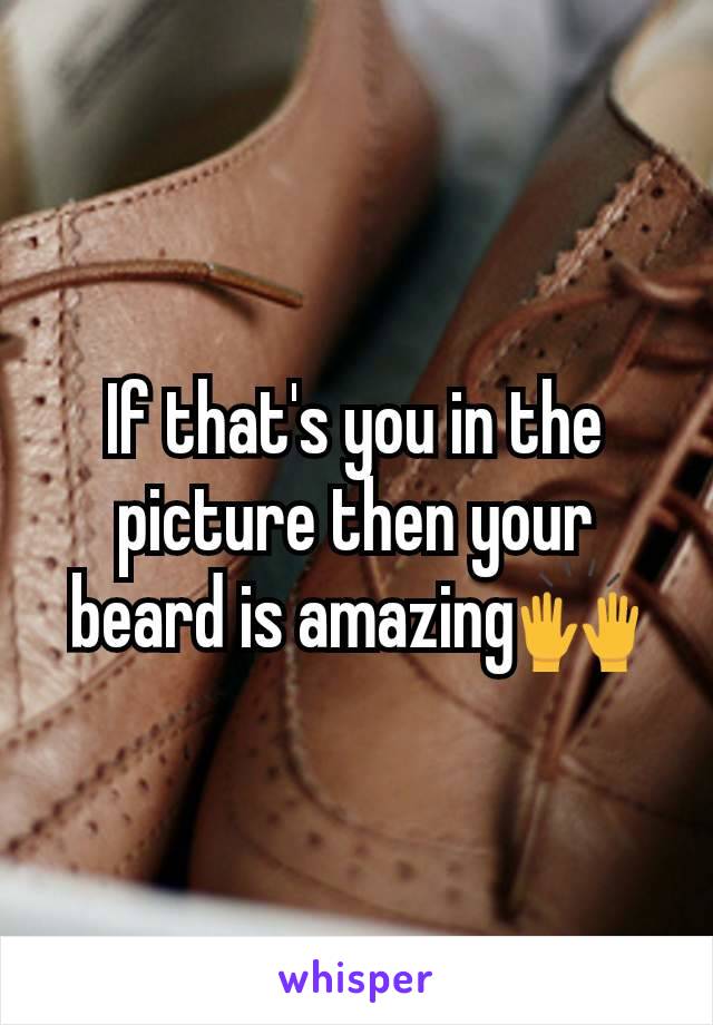 If that's you in the picture then your beard is amazing🙌