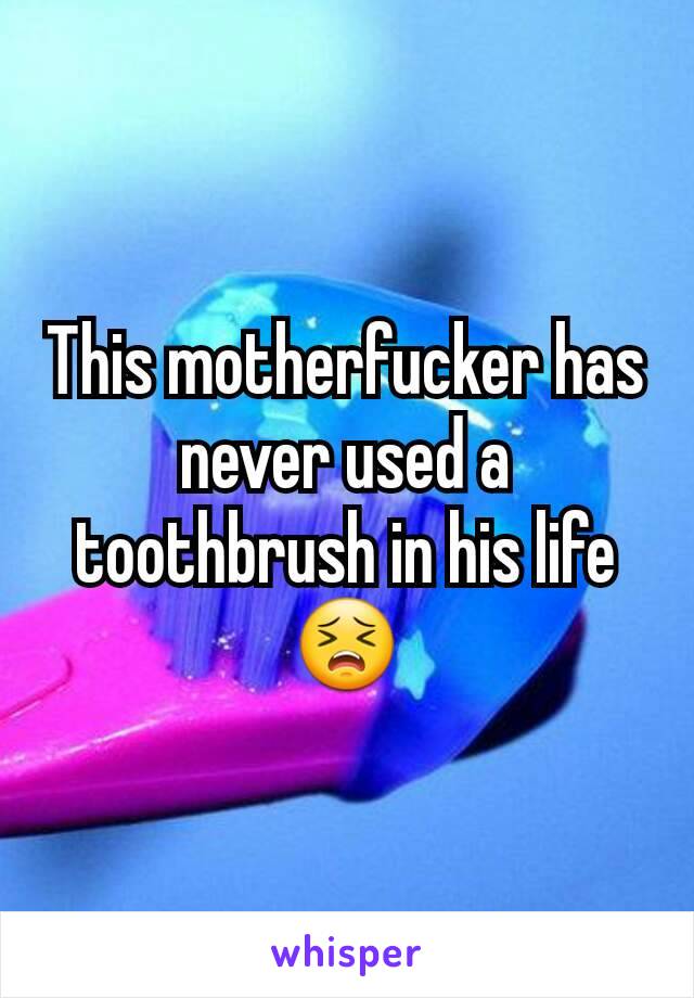This motherfucker has never used a toothbrush in his life 😣