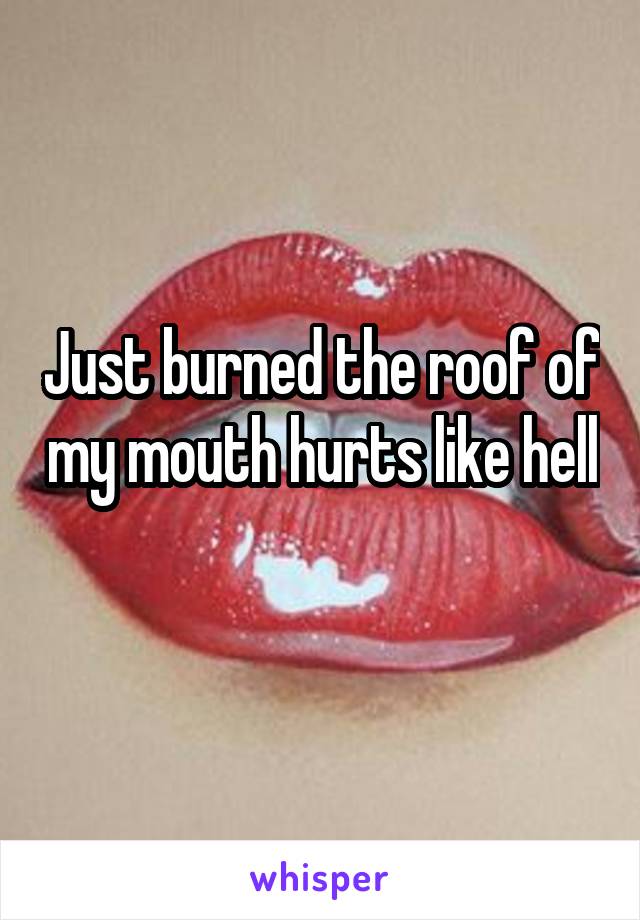 Just burned the roof of my mouth hurts like hell 