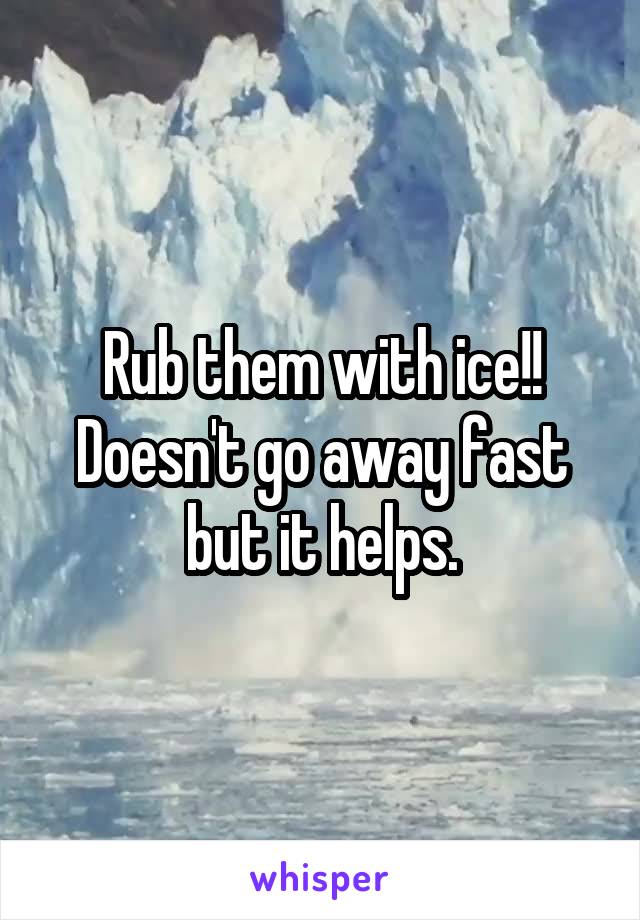 Rub them with ice!! Doesn't go away fast but it helps.