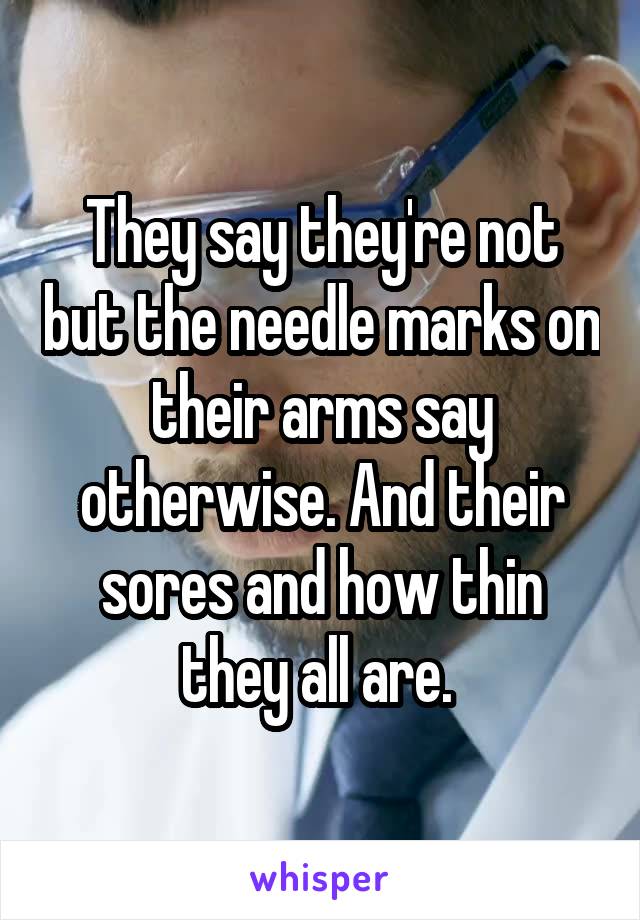 They say they're not but the needle marks on their arms say otherwise. And their sores and how thin they all are. 
