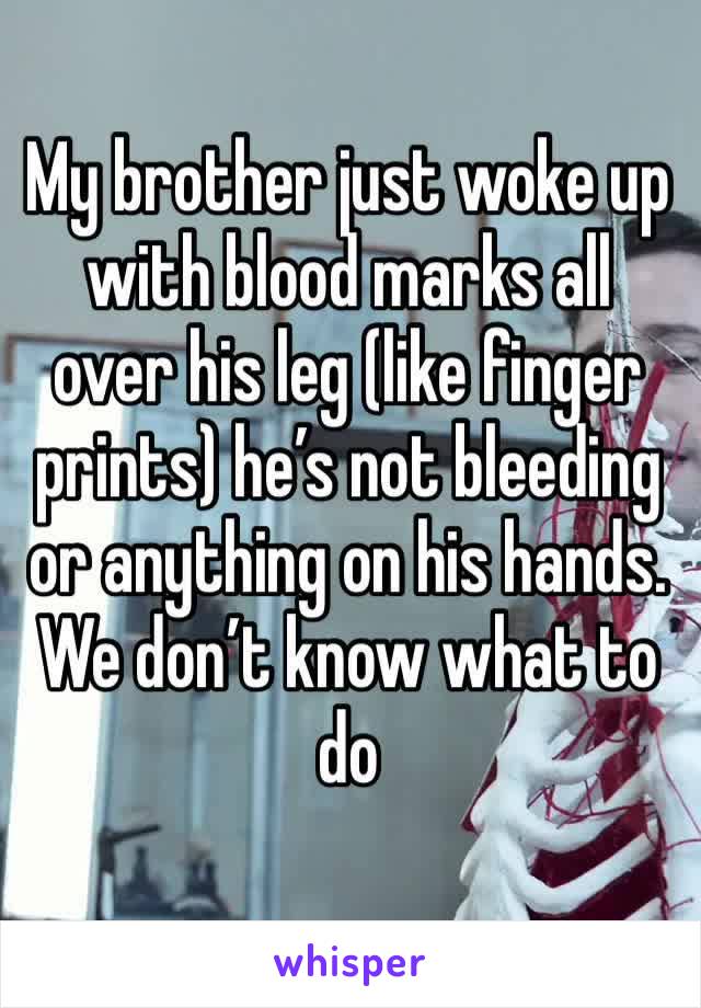 My brother just woke up with blood marks all over his leg (like finger prints) he’s not bleeding or anything on his hands. We don’t know what to do