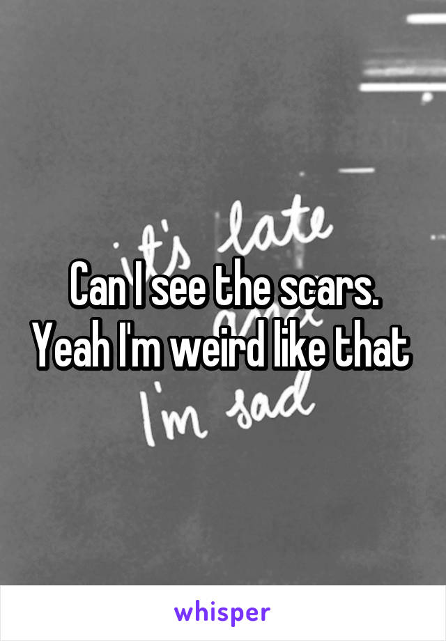 Can I see the scars. Yeah I'm weird like that 