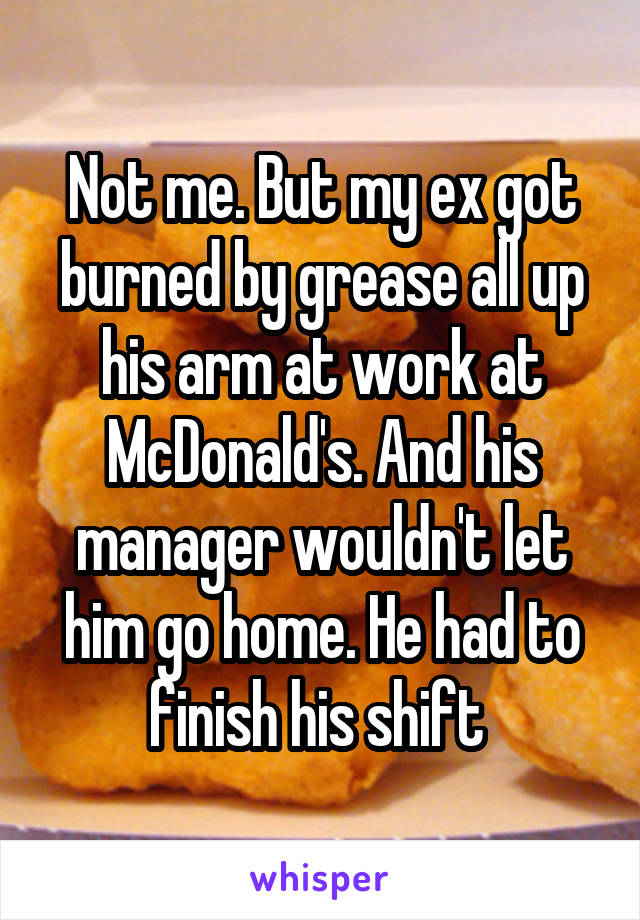 Not me. But my ex got burned by grease all up his arm at work at McDonald's. And his manager wouldn't let him go home. He had to finish his shift 