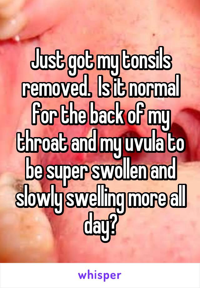 Just got my tonsils removed.  Is it normal for the back of my throat and my uvula to be super swollen and slowly swelling more all day?