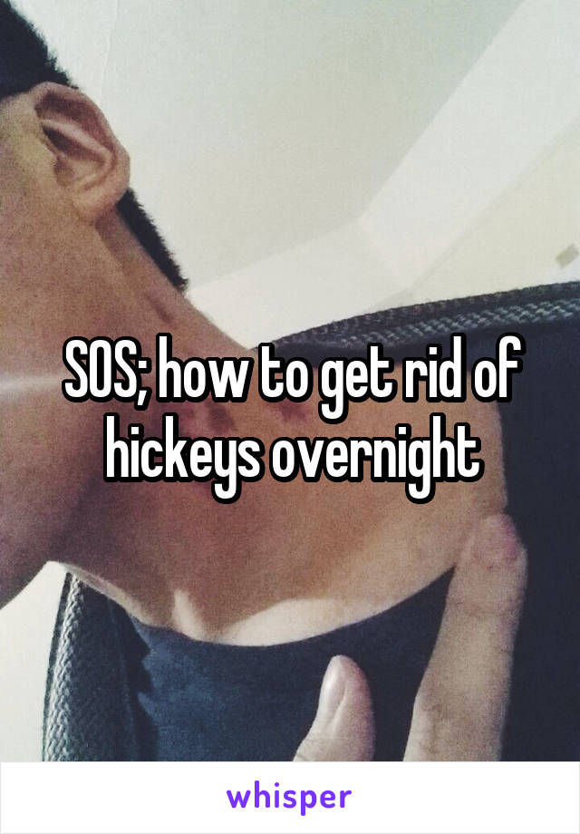 SOS; how to get rid of hickeys overnight