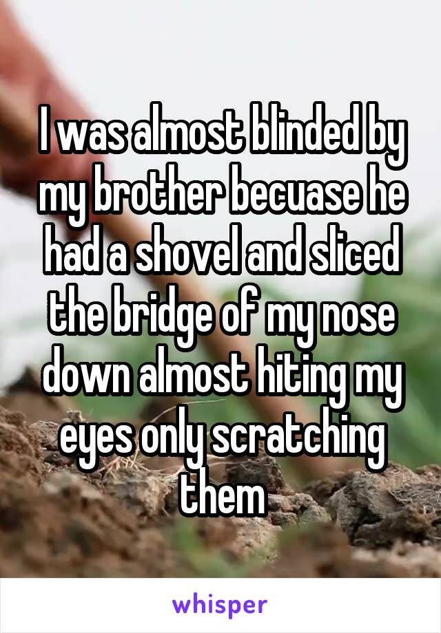 I was almost blinded by my brother becuase he had a shovel and sliced the bridge of my nose down almost hiting my eyes only scratching them