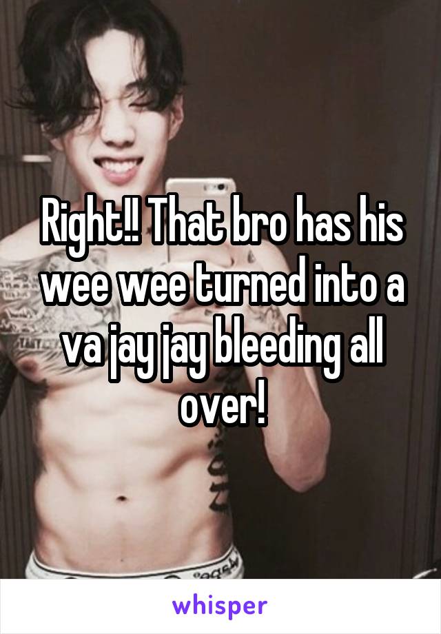 Right!! That bro has his wee wee turned into a va jay jay bleeding all over!