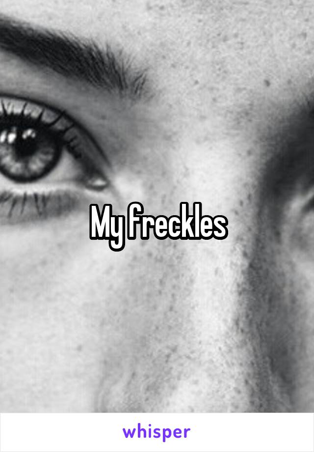 My freckles