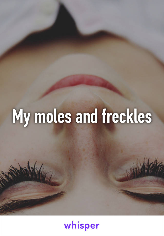 My moles and freckles