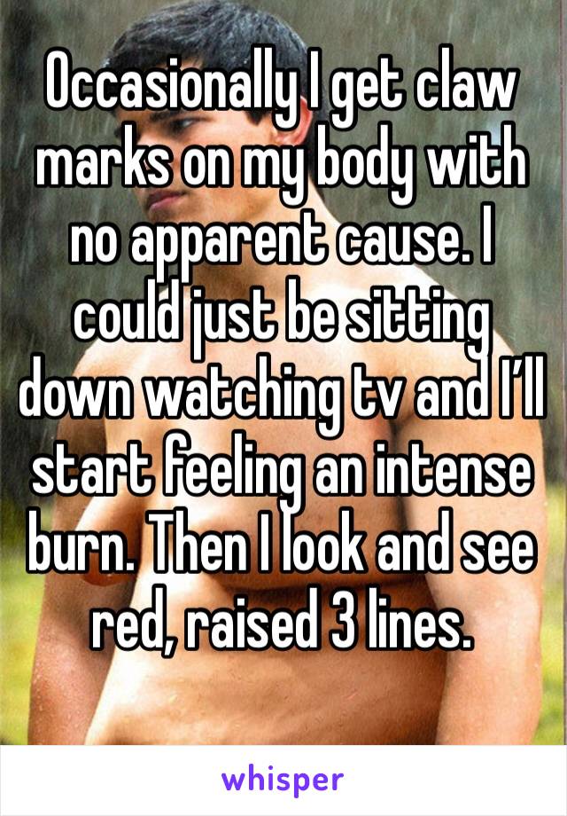 Occasionally I get claw marks on my body with no apparent cause. I could just be sitting down watching tv and I’ll start feeling an intense burn. Then I look and see red, raised 3 lines.