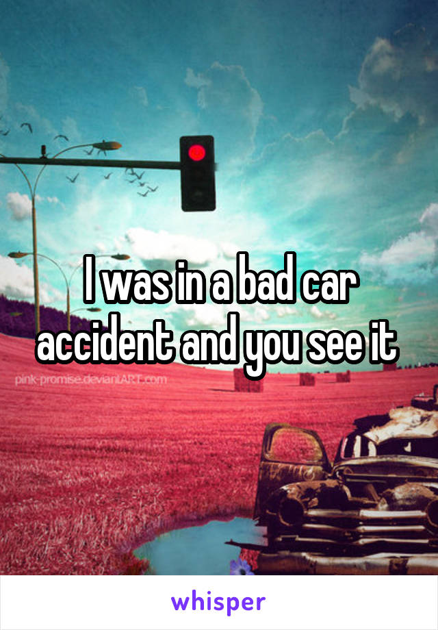 I was in a bad car accident and you see it 