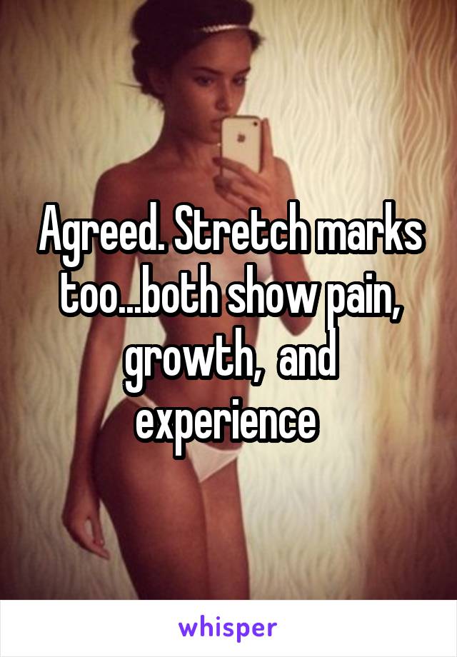 Agreed. Stretch marks too...both show pain, growth,  and experience 