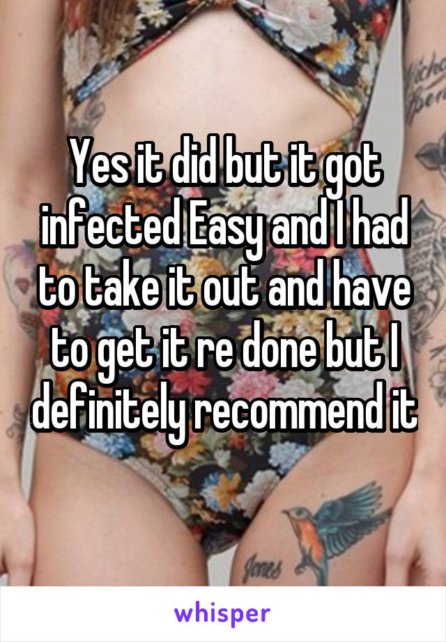 Yes it did but it got infected Easy and I had to take it out and have to get it re done but I definitely recommend it 