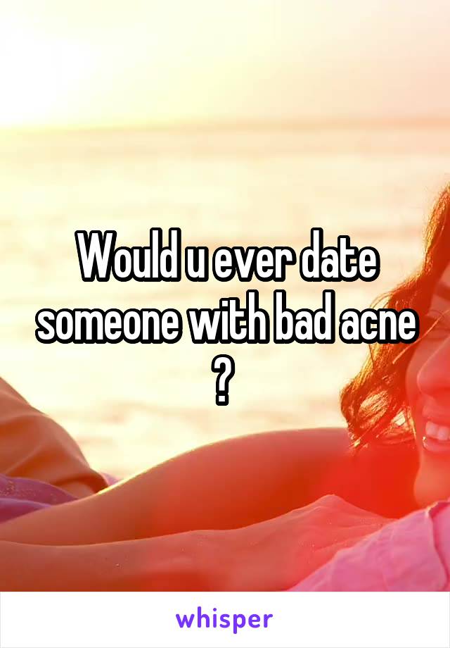 Would u ever date someone with bad acne ? 