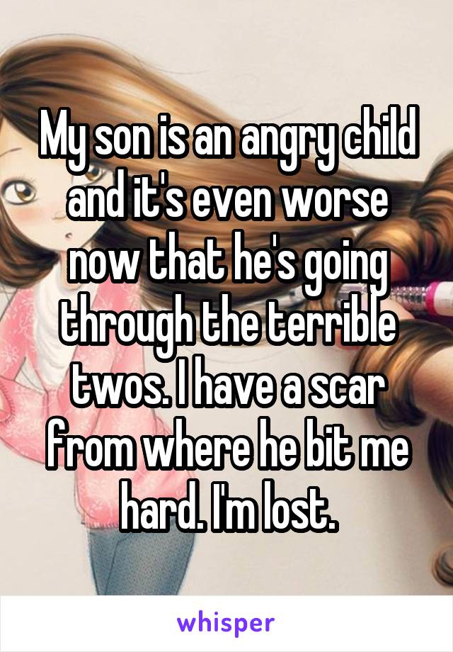 My son is an angry child and it's even worse now that he's going through the terrible twos. I have a scar from where he bit me hard. I'm lost.