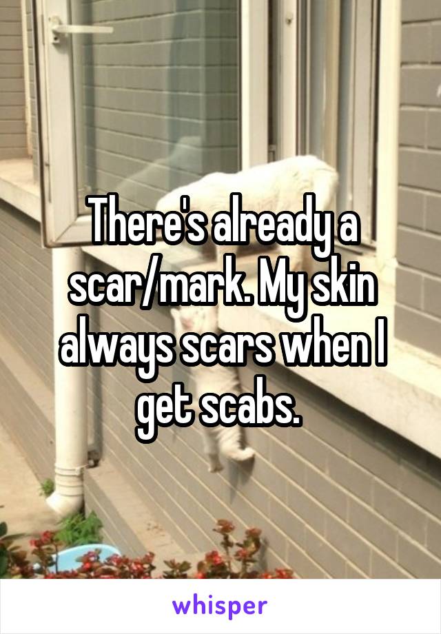 There's already a scar/mark. My skin always scars when I get scabs. 