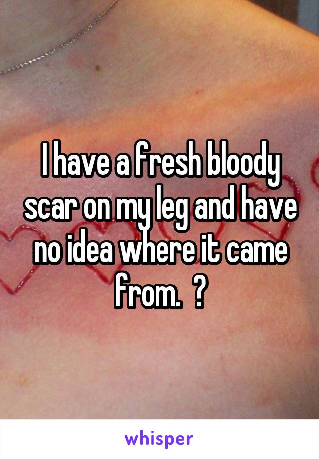 I have a fresh bloody scar on my leg and have no idea where it came from.  😭