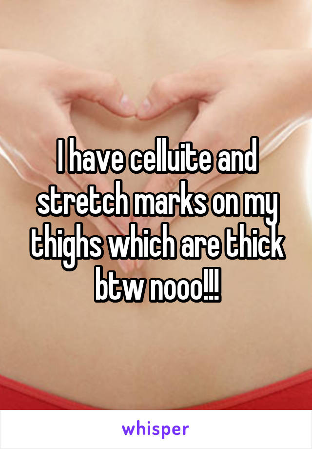 I have celluite and stretch marks on my thighs which are thick btw nooo!!!