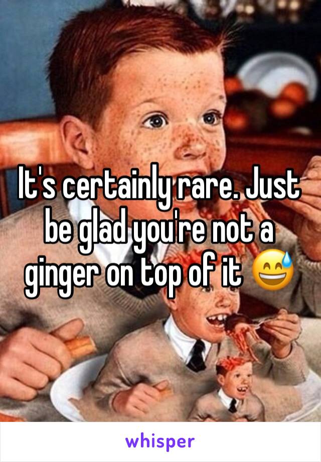It's certainly rare. Just be glad you're not a ginger on top of it 😅