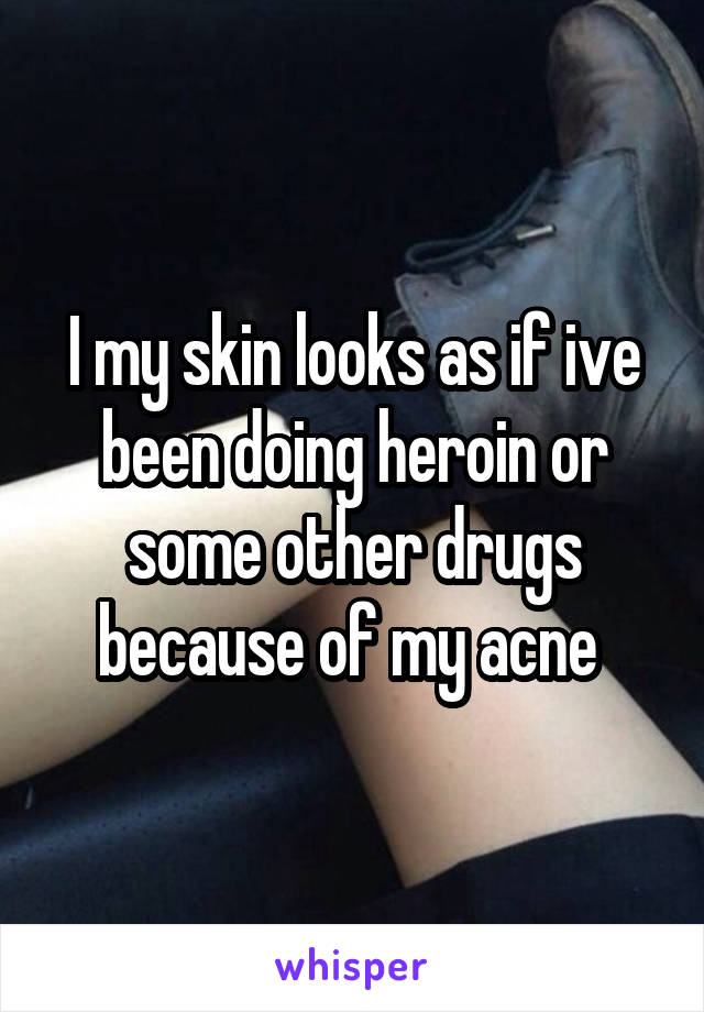 I my skin looks as if ive been doing heroin or some other drugs because of my acne 