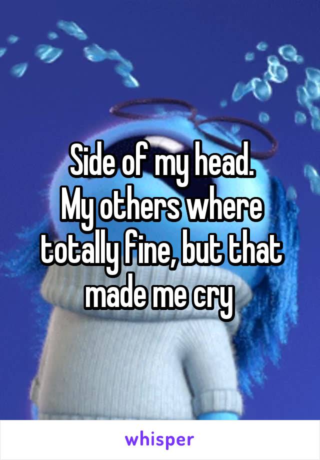 Side of my head.
My others where totally fine, but that made me cry 