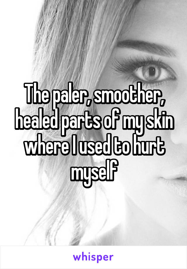 The paler, smoother, healed parts of my skin where I used to hurt myself