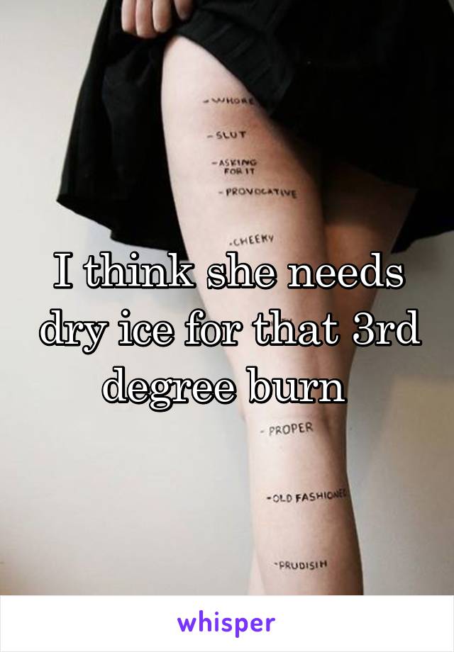 I think she needs dry ice for that 3rd degree burn 