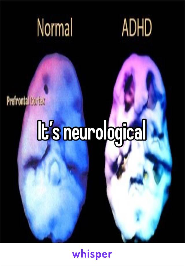 It’s neurological