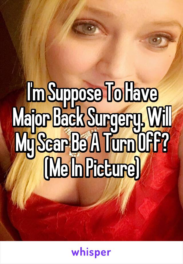 I'm Suppose To Have Major Back Surgery. Will My Scar Be A Turn Off? (Me In Picture)