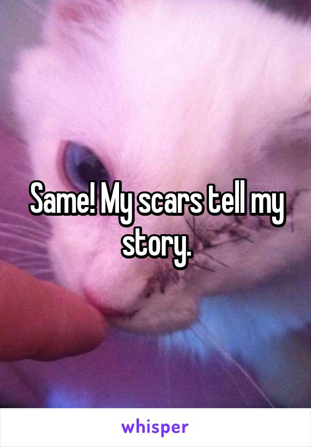 Same! My scars tell my story.