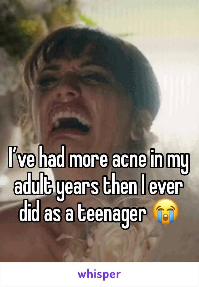 I’ve had more acne in my adult years then I ever did as a teenager 😭
