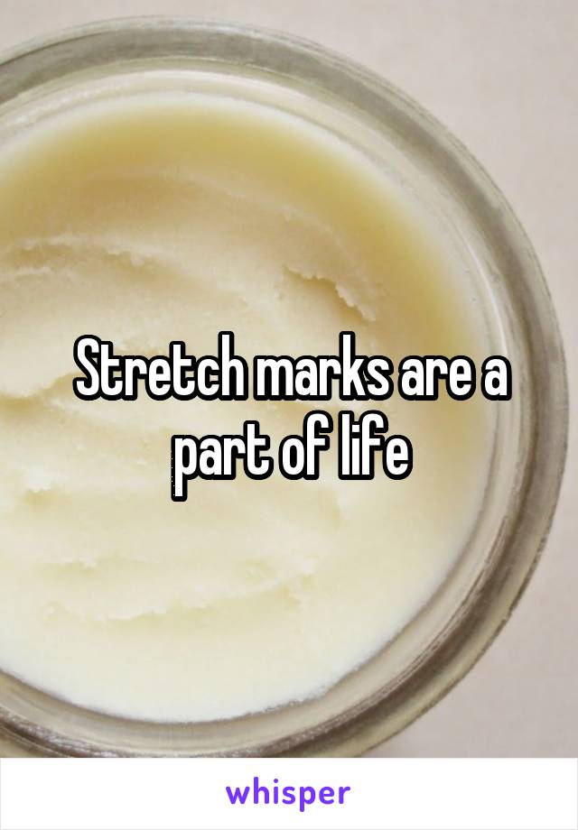 Stretch marks are a part of life