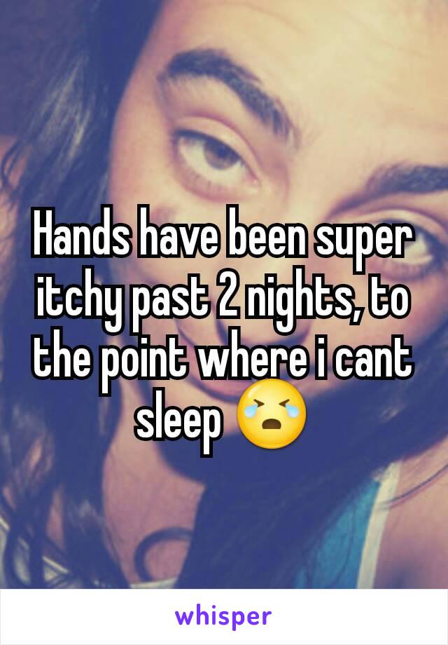 Hands have been super itchy past 2 nights, to the point where i cant sleep 😭