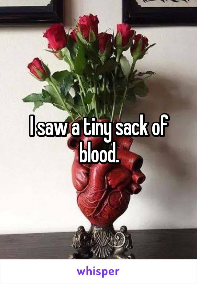 I saw a tiny sack of blood.