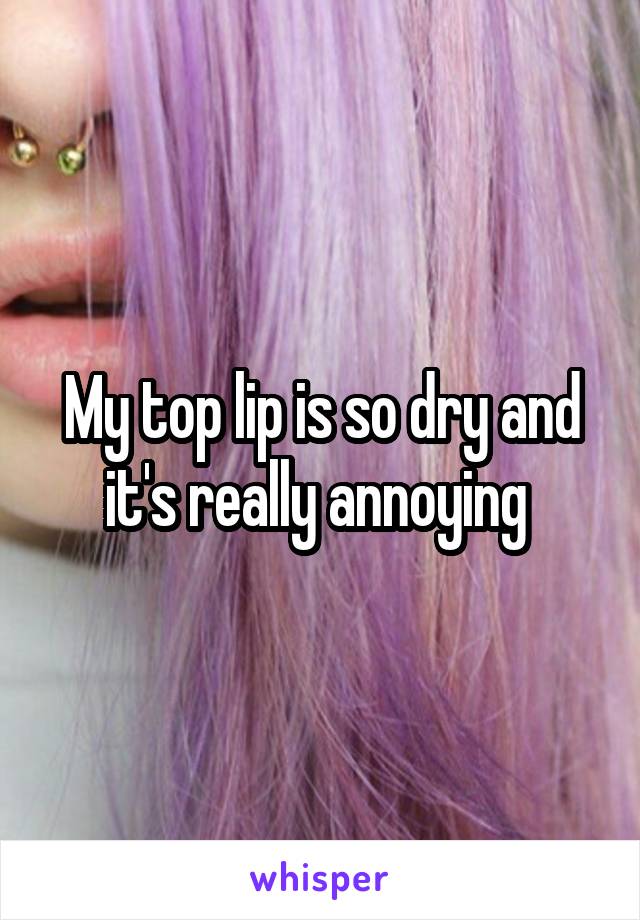 My top lip is so dry and it's really annoying 