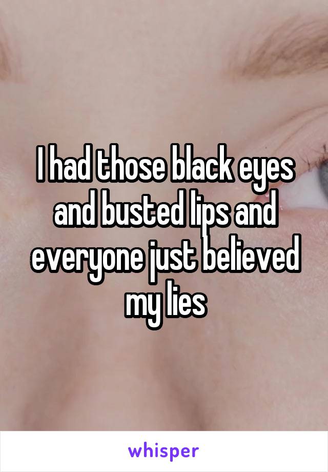 I had those black eyes and busted lips and everyone just believed my lies