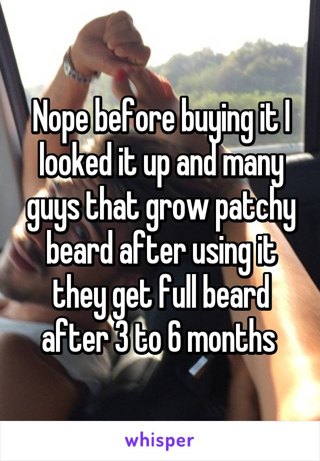 Nope before buying it I looked it up and many guys that grow patchy beard after using it they get full beard after 3 to 6 months 
