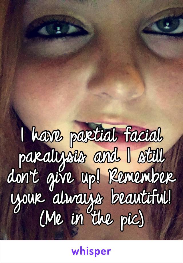 I have partial facial paralysis and I still don’t give up! Remember your always beautiful! (Me in the pic) 