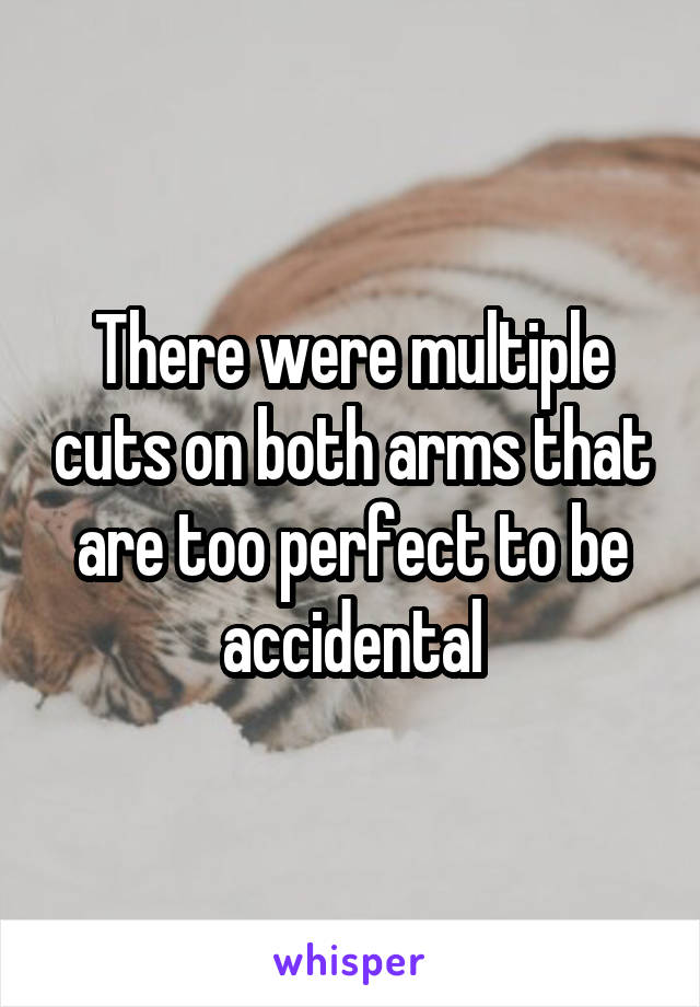 There were multiple cuts on both arms that are too perfect to be accidental