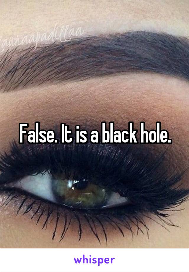False. It is a black hole.